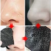 10pcs Nose Strips For Blackheads Acne Removal Instant Pore Unclogging Strips Deep Cleansing Nose Clean Patch New 3