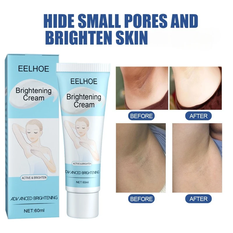 

Effective Improve Body Whitening Cream Armpit Legs Knee Elbow Bleaching Cream Dull Remove Dark Spots Melanin Brighten Skin Care