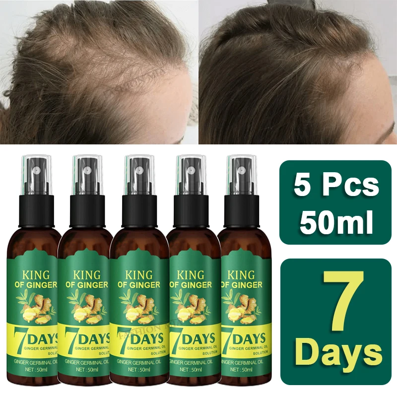 

2024 Hot 3/5Pcs 50ml Biotin Fast Ginger Hair Growth Serum Anti-Loss Hair Regrowth Treatment Essential Oil Hair Care Growth Spray
