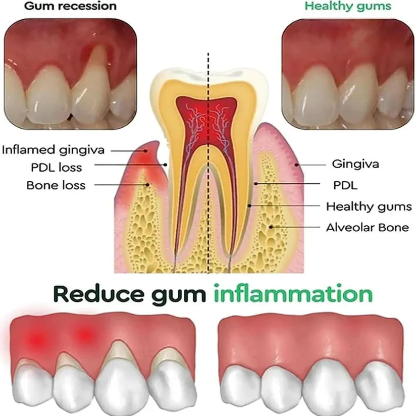 60ML Natural Oral Care Liquid Soothe Dental Discomfort Support Healthy Gum Condition Daily Oral Hygiene Supply - 2