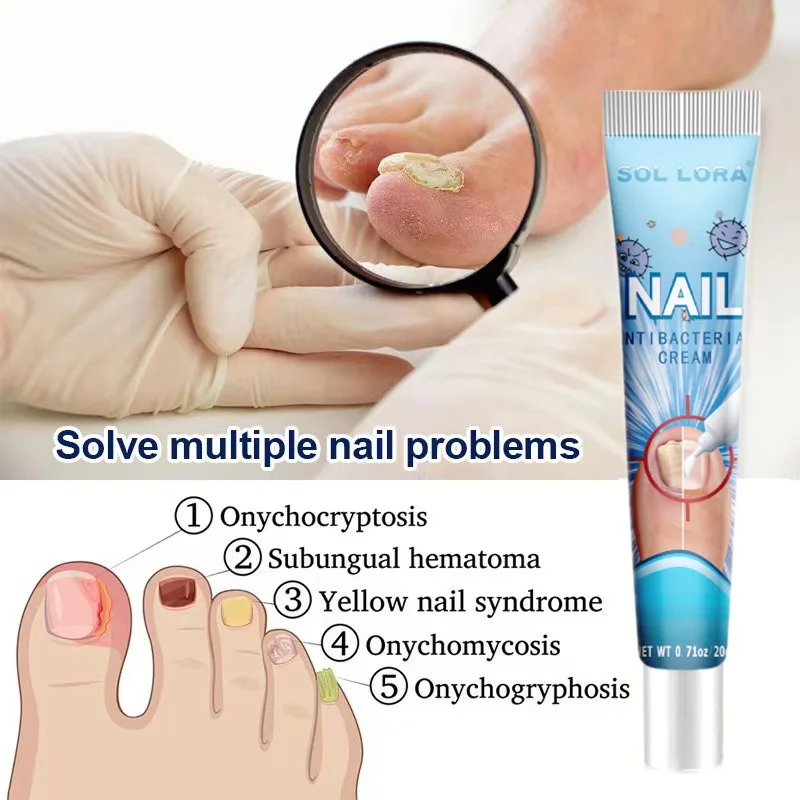 Corded Nail Fungal Lamp Treatment Device Repair Toenail Fingernail Fungus Treat Onychomycosis Laser Nails With Toe Care Cream