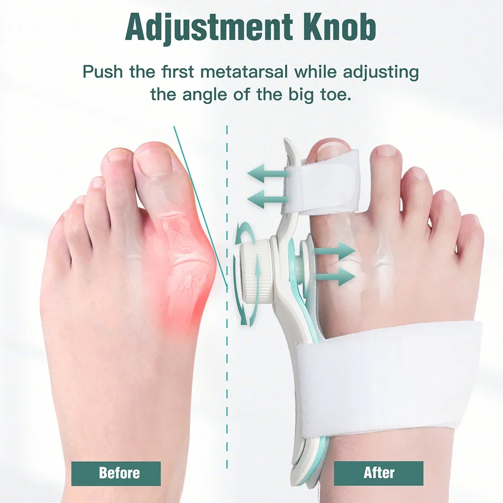 New Bunion Corrector Hallux Valgus Orthotics Big Toe Homing Straightener Adjustable Knobs With 3 Angle Fixing Plate Foot Care