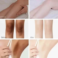 Crème éclaircissante pour le corps, bras, cuisses, aisselles, genoux, crème éclaircissante hydratante, produits de soin de la peau coréens 2