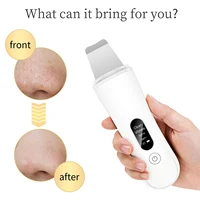 Skin Scrubber Spatula Type-C Charging Ultrasonic Face Clean Machine Ultrasonic Blackhead Peeling Shovel for Facial Lifting Clean 6