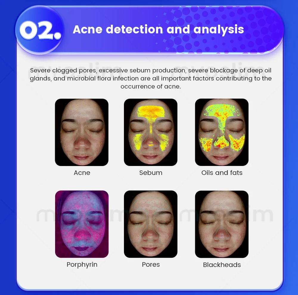 X5 Hautanalyse-Gerät Magic Mirror 3D Digitaler Gesichtsanalysator KI-Intelligentes Bildgebungsgerät Detektor für Kopfhaut-Gesundheitsanalyse – Detail 9