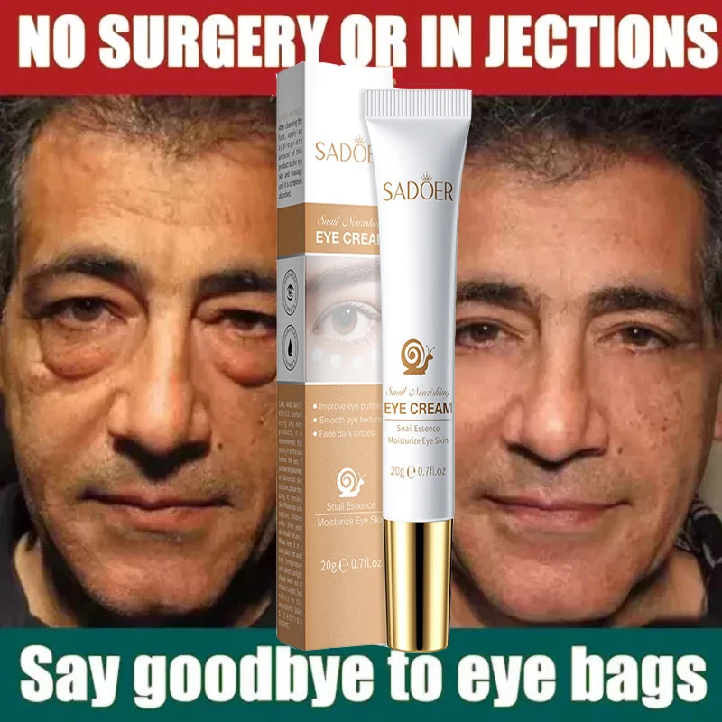 Instant Eye Bag Removal Cream Collagen Removal Wrinkles Lifting Fade Fine Lines Moisturizing Brightening Anti Puffiness Eye Care eye cream