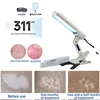 Original 311nm UVB Phototherapy For Vitiligo, Eczema, Psoriasis, UVB Lamp, Skin Problem Treatment Lamp 1