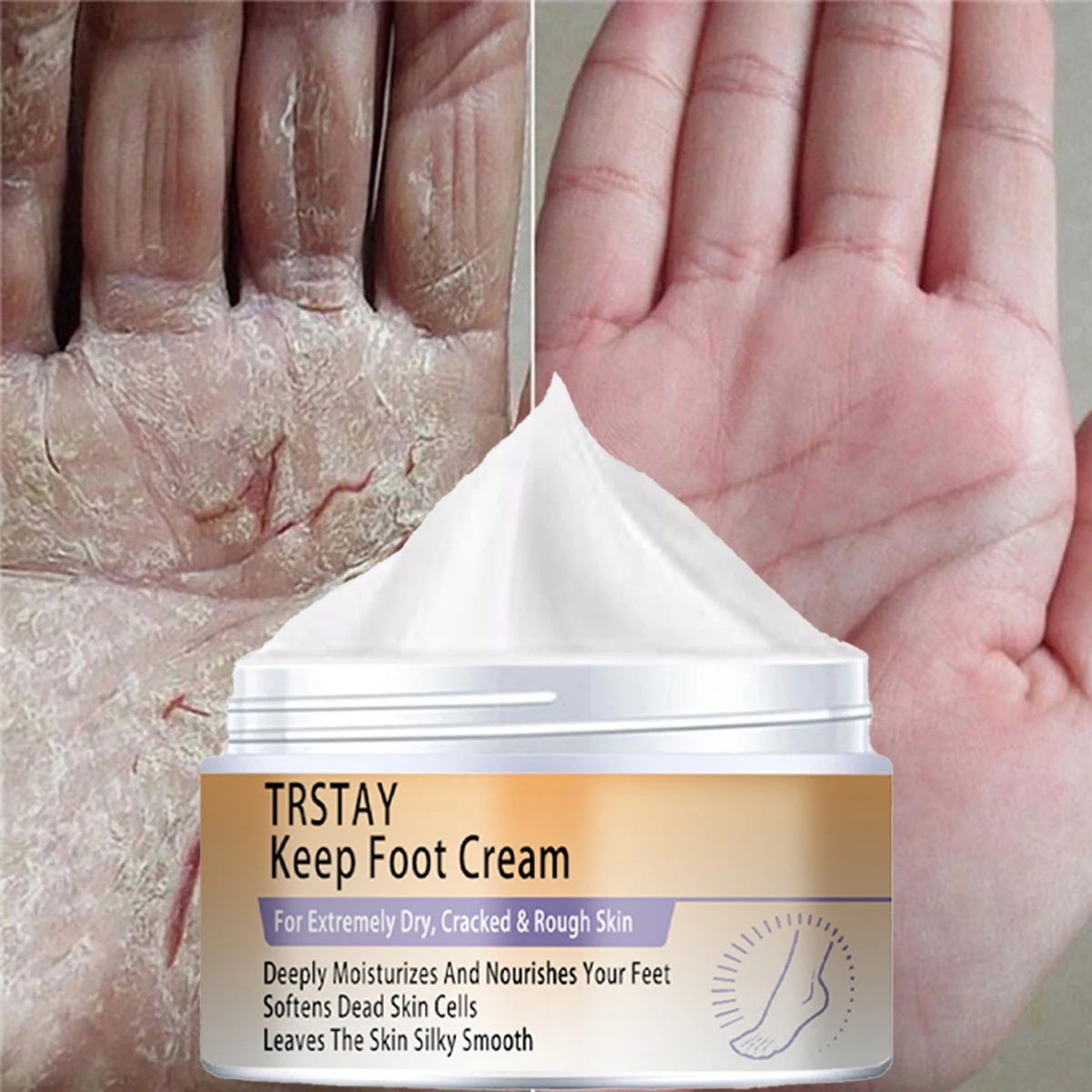 Trstay Balm Cream for Rough Dry Cracked Chapped Hand/Feet – Porpop