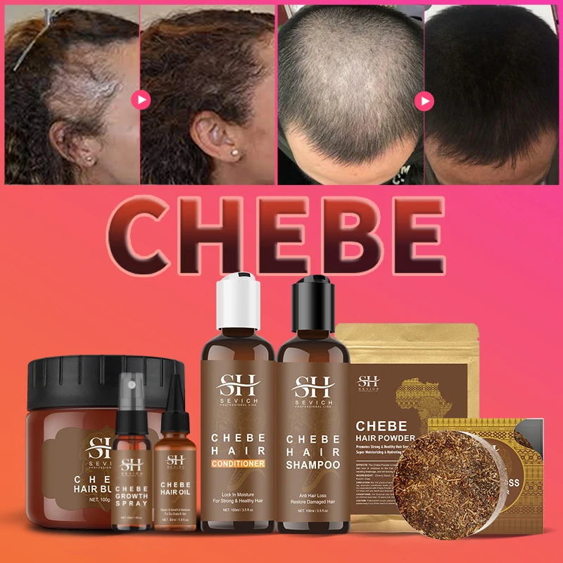 

NEW chebe Traction Alopecia Thicken Oil Hair Loss Treatment Spray Craze Fast Hair Growth Products Sevich Anti Break Hair Care