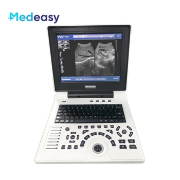 Dispositivo diagnostico digitale completo per scanner a ultrasuoni portatile da 12 pollici per notebook B