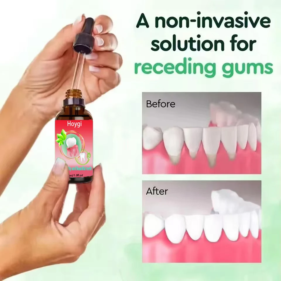 Whitening teeth quickly repair gums