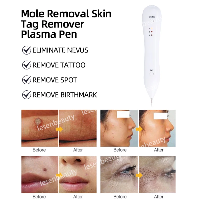 Plasma Pen 9 level Spot Removal Pen Tattoo Mole Removal Facial Freckle Dark Remover Tool Wart Skin Tag Remover Device