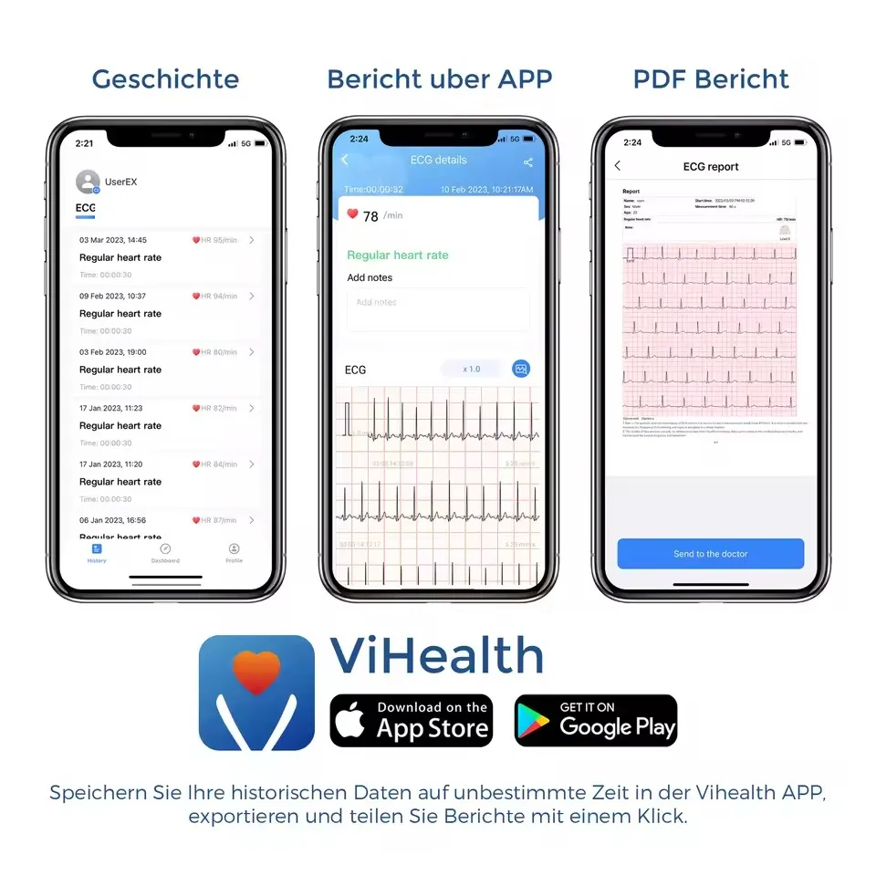 Ex Portable EKG Monitor Professional Analysis Telemedicine EKG Machine Wireless Electrocardiograph Pulsebit