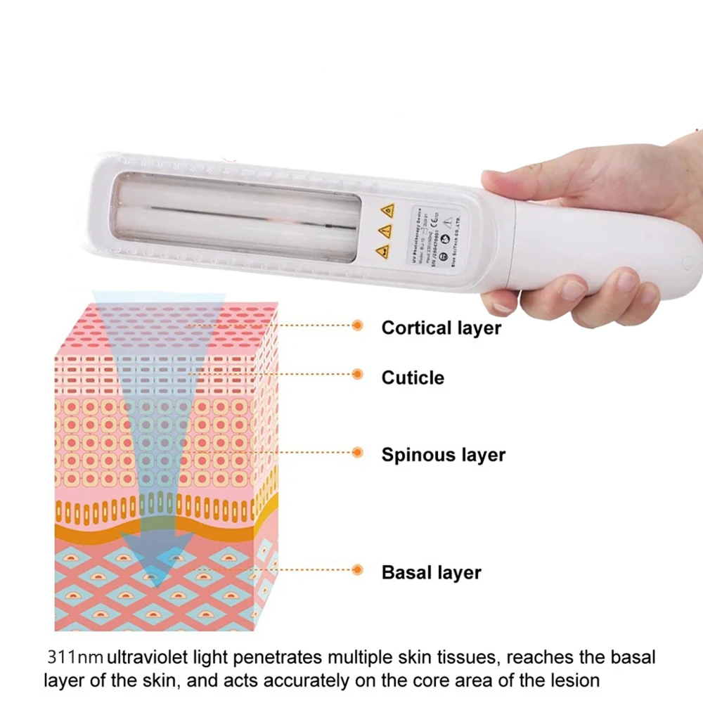UV 311nm Ultraviolet Phototherapy Device 311nm UVB Lamp To Treat Vitiligo, Psoriasis, White Spots And Skin Disease - Image 4