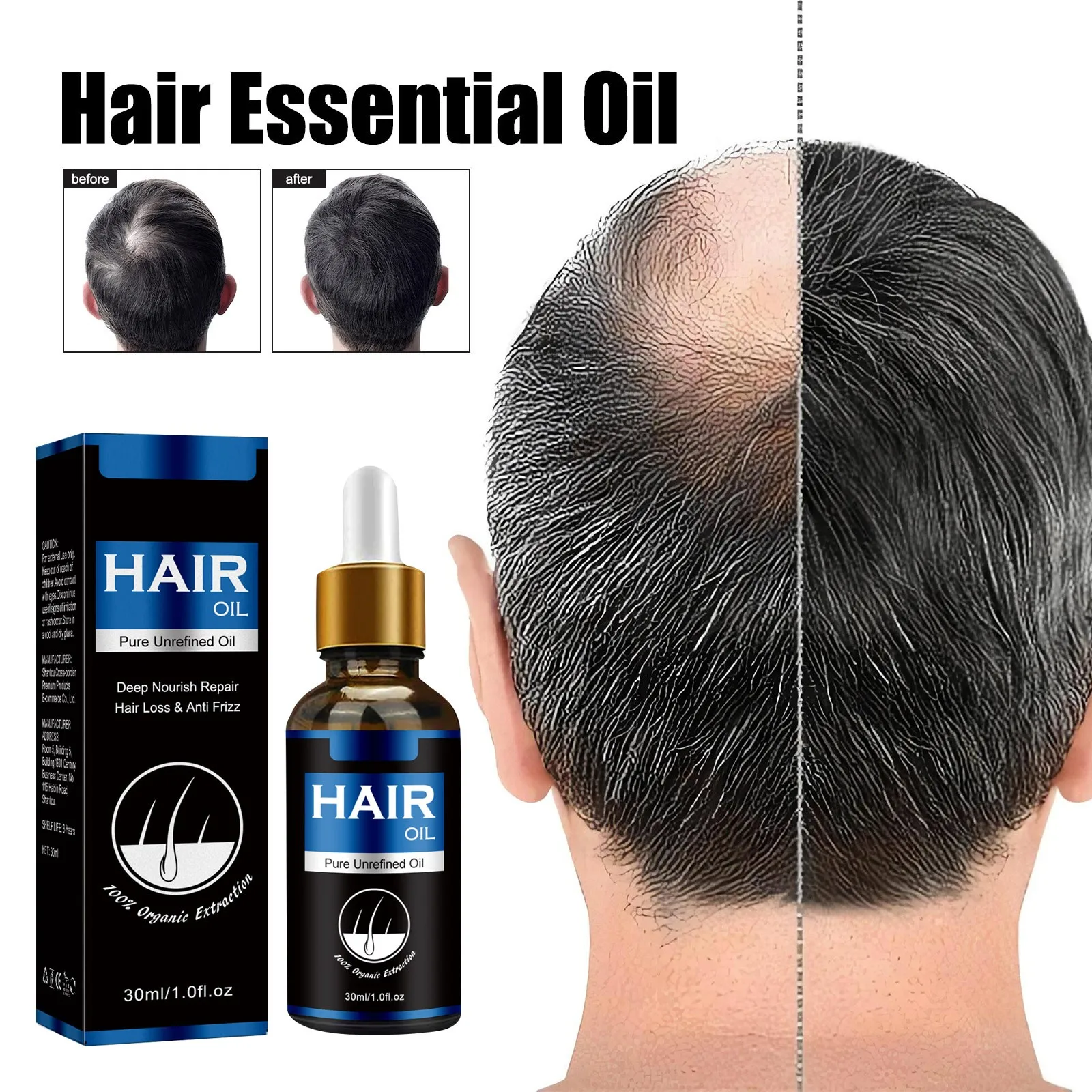 Hair Growth Liquid Nourishes Hair And Repairs Damaged Refreshing And Non Greasy Care Liquid 30ml