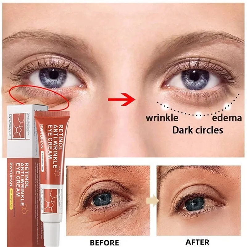 Eye Cream Retinol Anti Wrinkle Anti-aging Remove Dark Circles Products Moisturizing Improve Eye Bags Firming Eye Care Beauty
