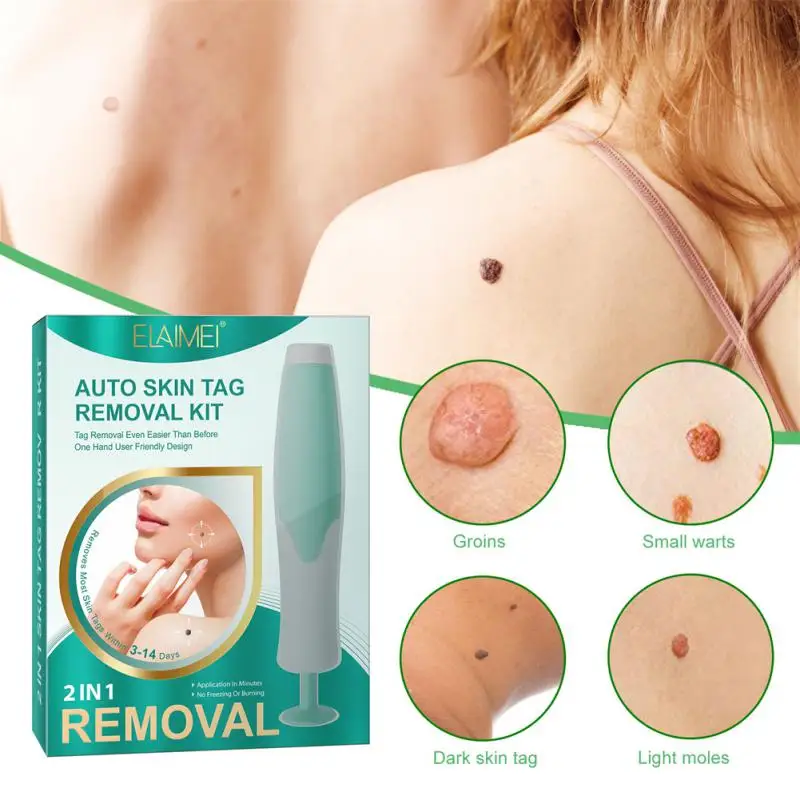 

Skin Tag Removal Kit Easy And Painless Includes Cleansing Swabs Dermatologist Recommended Safe And Effective Safe Affordable
