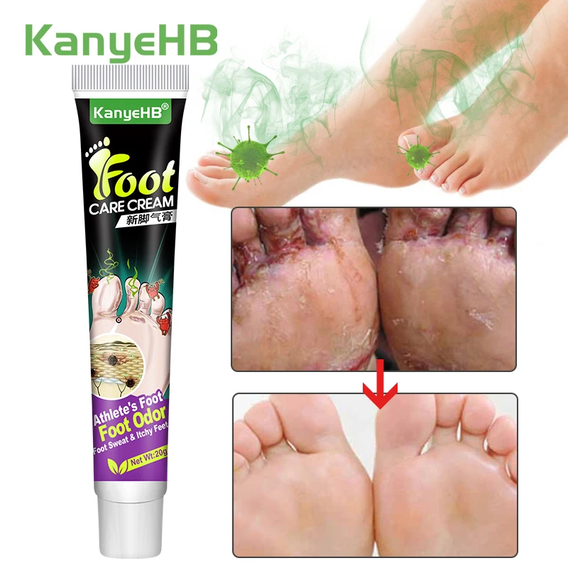 1Pcs Athlete Foot Ointment Relief Itch Pain Remove Foot Odor Inhibit