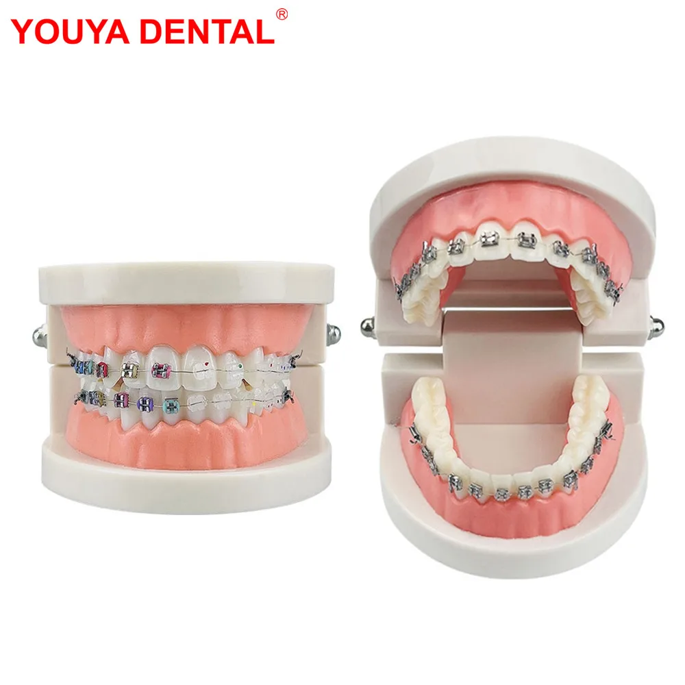 

Dental Orthodontic Teeth Model With Braces Dental Teaching Model Metal / Ceramic Brackets For Dentistry Education Studying Demo