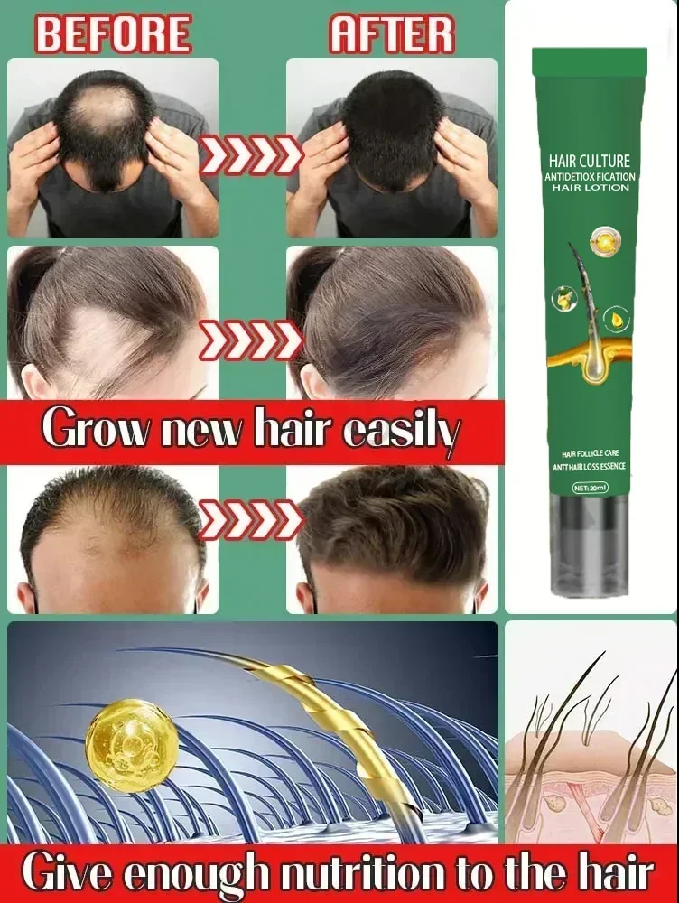 Successful products, 99% of buyers will buy again, they have more and more hair, say alpha baldness, thick hair