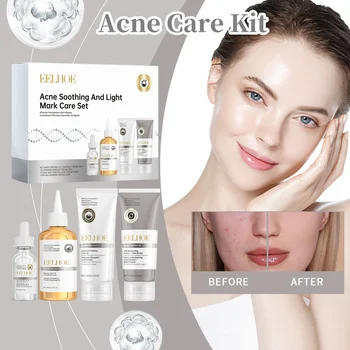 Acne Care Kit Brightening Skin Tone Fade Acne Scars Improving Skin Texture Deeply Moisturizing The Skin Facial Skincare Products 1