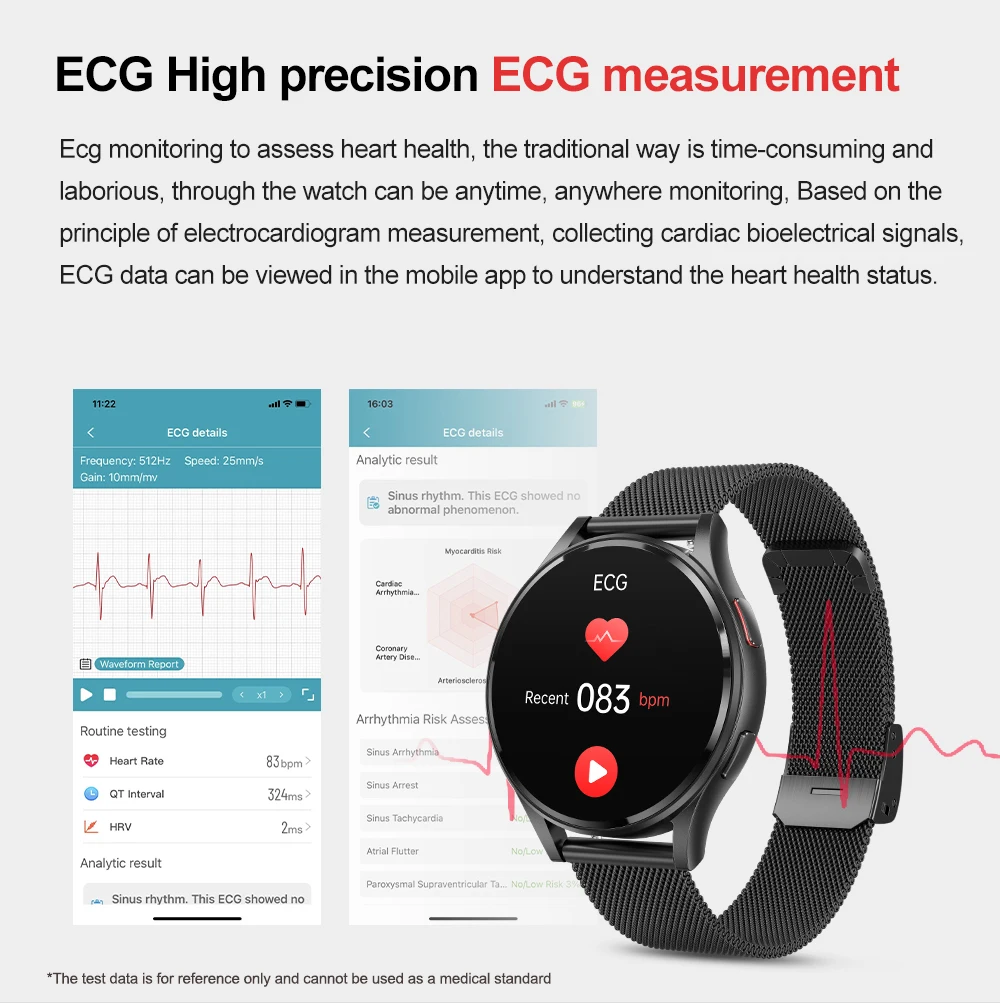  ȭ AI  ECG ǰ ͸,  Ʈġ,  ƮϽ ƮĿ, GE30 Ʈ ġ, 1.43 ġ Ƹ ũ