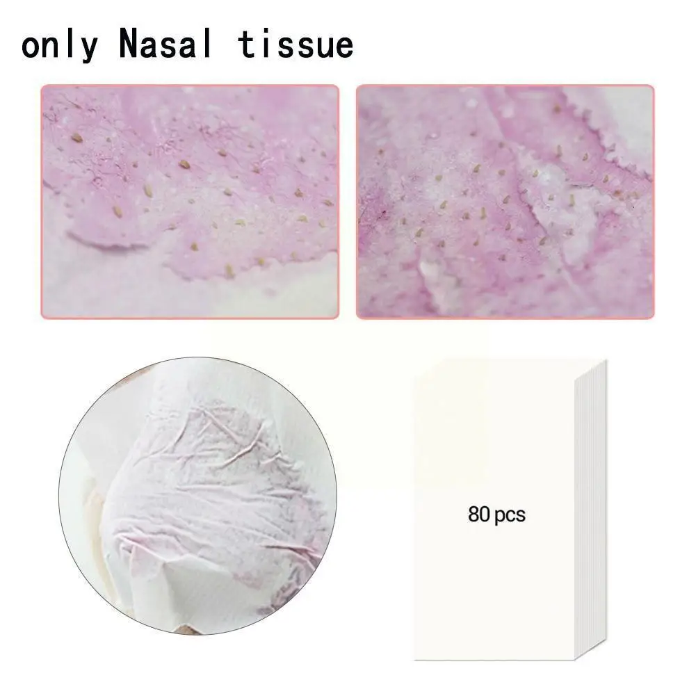 Рисунок 4 - полоски для удаления чёрных точек