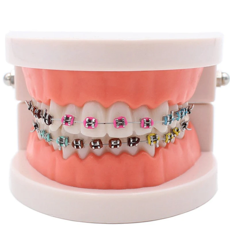 DentalStandardOrthodonticModelWithMetalCeramicBracketsLigature