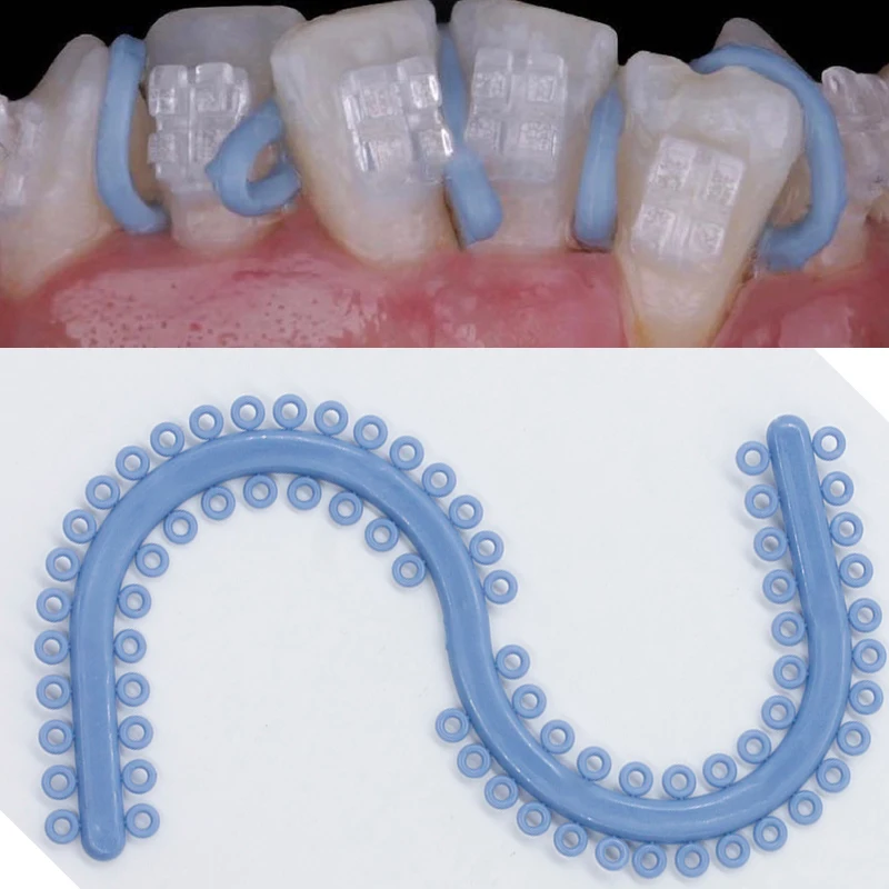 1000Pcs Separador De Ortodoncia Dental Lazos De Ortodoncia Separadores De Dientes De Corbatas Separadas De Ortodoncia Elastica