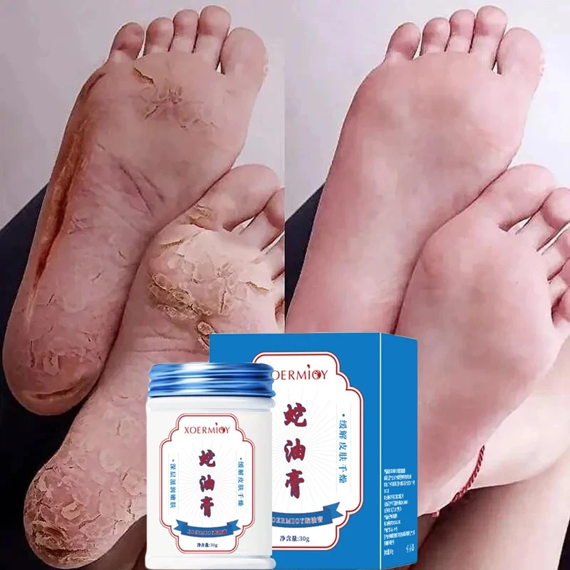 Foot cream Herbal Anti Crack Foot Cream Heel Crack Repair Products Exfoliating Dead Skin Removal Softening Moisturising Skin Care Men Woman
