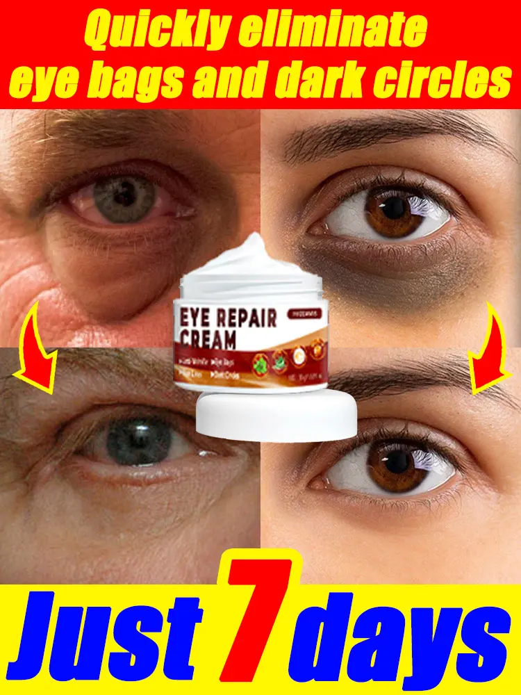 Eye Cream Repairing Problems Around Eyes