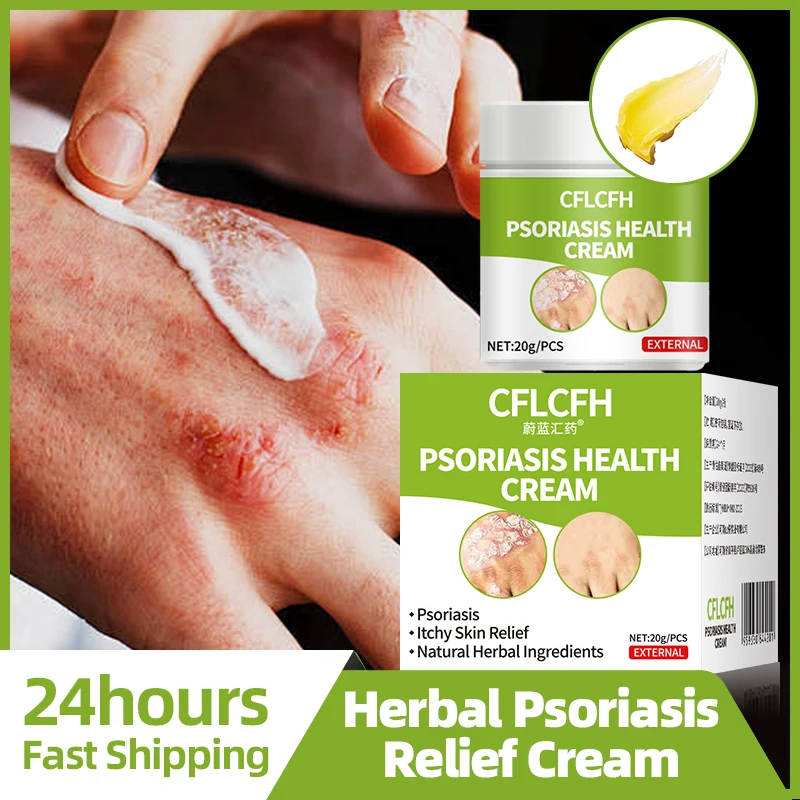 

Psoriasis Treatment Cream Skin Care Eczema Eczematoid Dermatitis Fungus Antibacterial Anti-itch Health Ointment 20g