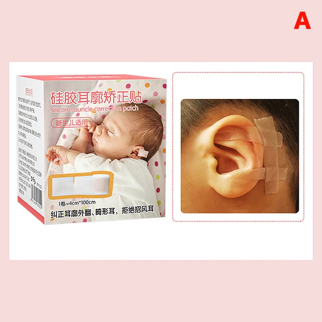Corrector de orejas para bebé, parche adhesivo de silicona para niños,  5x100cm - AliExpress