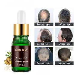 Hair Growth Essential Oil Hair-Restorer Prevent Hair Loss Treatment Fast Grow Hair Repair Pilatory Promote Hair Growth Regrowth