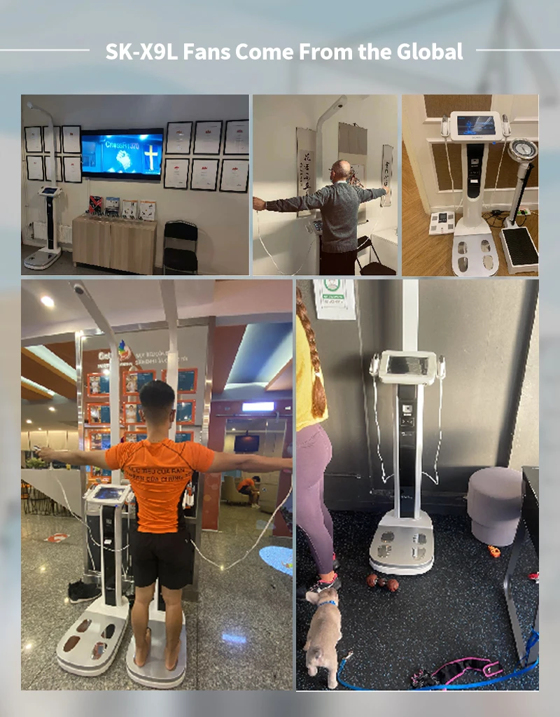 Sonka medical body composition analyzer impedance bmi machine 3d