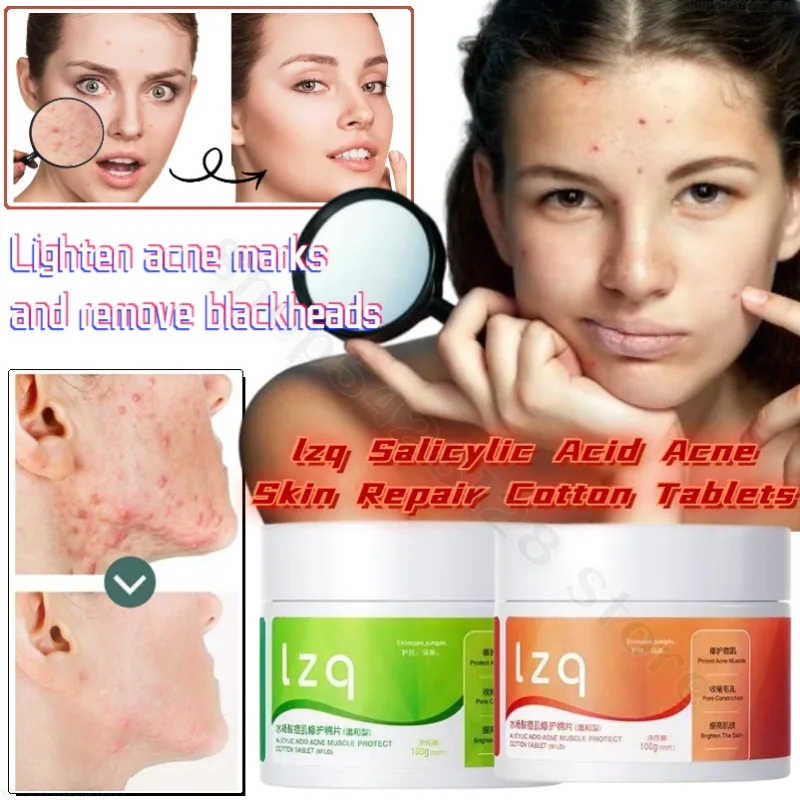 Lzq Salicylic Acid Deep Skin Repair Cotton Pads Improve Facial Acne Fade Acne Marks Clean Gentle and Soothe The Skin salicylic acid acne muscle repair cotton pads remove oil improve oil acne remove closed acne blackheads fade acne marks clean