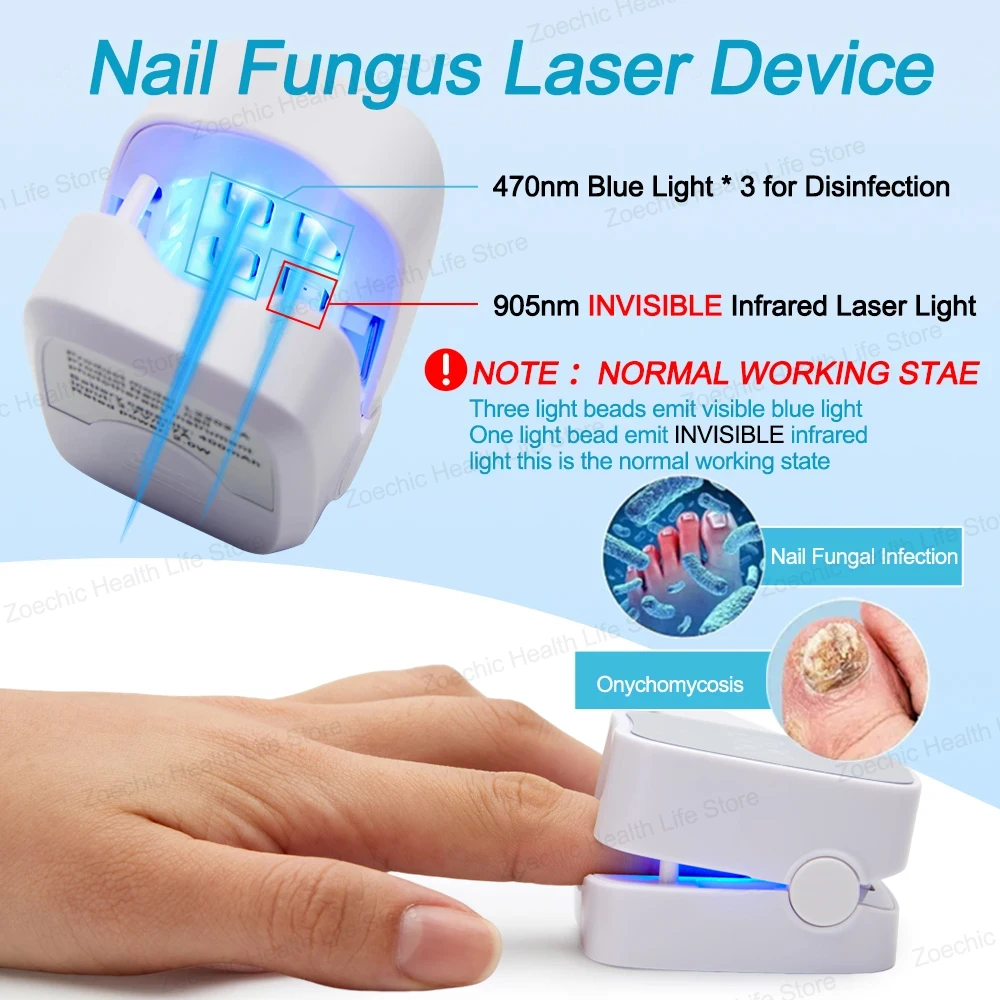 Fungal Nail Treatment Laser Device Time Display Blue Light Therapy for Fingernails and Toenails Onychomycosis Cure Machine nail fungus remover