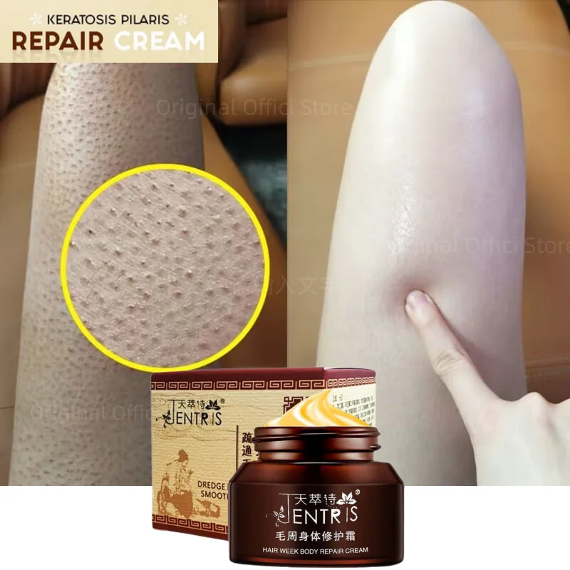 50g Curing Keratosis Pilaris Chicken Follicle Skin Repair Cream Body
