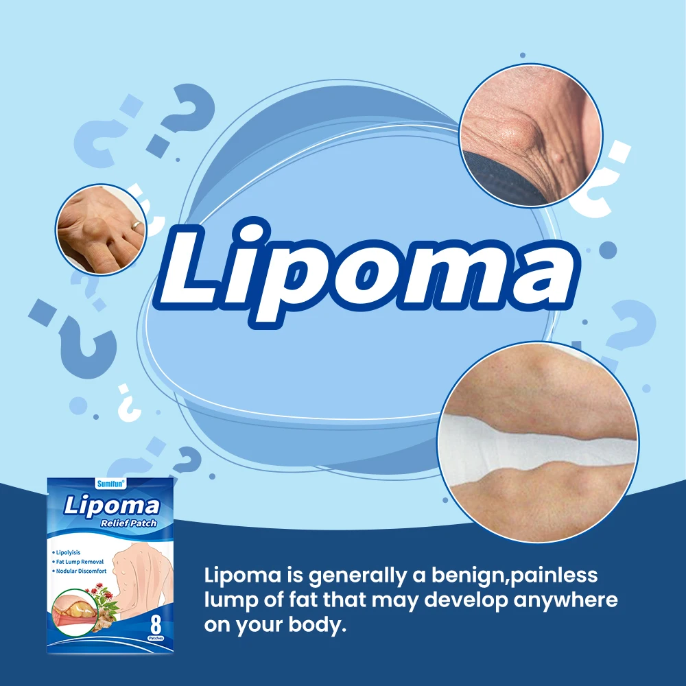8/40/80Pcs Sumifun Lipoma Removal Patch Anti Skin Tumor Swelling Fat Lump Nodular Reduce Inflammation Subcutaneous Mass Plaster pain relief patch