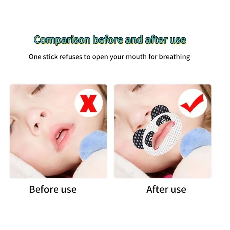 30Pcs Baby Sleep Strips Hypoallergenic Anti-open Mouth Sleeping Tape Kids Adult Breathing Correction Patch Baby Care Tools