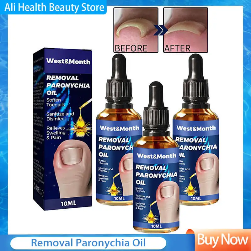 

3pcs 10ml Toenailcare Removal Paronychia Oil Ingrown Toenail Treatment Best Nail Repair Solution Nail Renewal Liquid