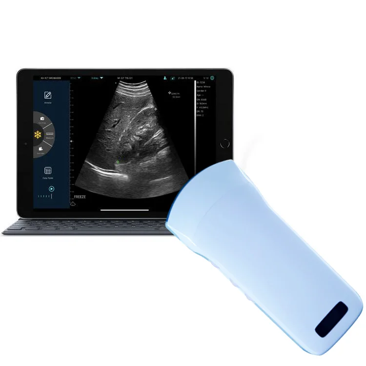 

Wireless WiFi Handheld Color Doppler Ultrasound Machine/Portable Ultrasound machines For Sale