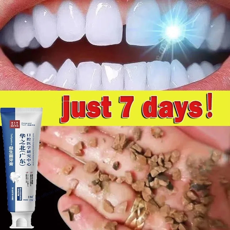 

Quick Repair of Cavities Caries Toothpaste Whitening Yellowing Dark Teeth Removal of Plaque Stains Oral Clean Decay Serum 100g