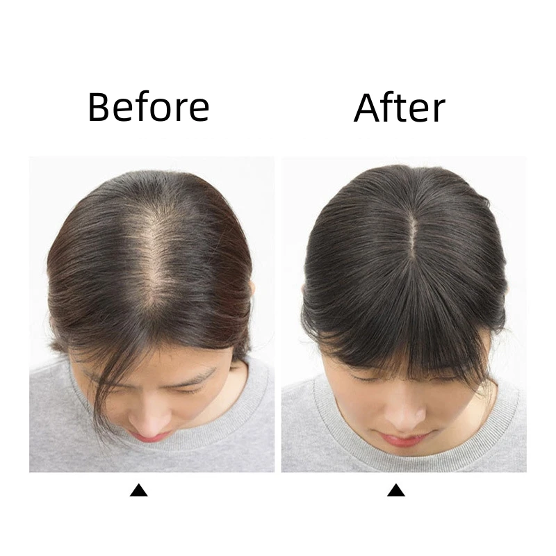 Human Hair Toppers Silk Hair Toppers 7x8cm Slik Human Hair Toppers For Women Thin Clip In Topper 3D Air Bangs Hairpieces for Hair Loss Volume Cover Grey