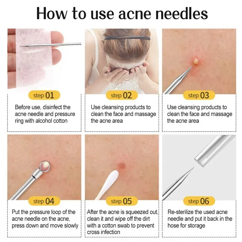 11Pcs Acne Needle Blackhead Clip Remover Extraction Pore Black Head Clean Face Skin Care Cleansing Needle Blemish Removal Tool 5