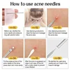 11Pcs Acne Needle Blackhead Clip Remover Extraction Pore Black Head Clean Face Skin Care Cleansing Needle Blemish Removal Tool 5