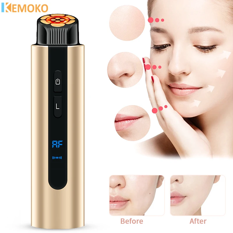 HIFU Face Lifting Facial Radiofrequency Mini Ems Micro Current Face Lift Rejuvenating Wrinkle Resistant High frequency Massager 5pcslarge micro switch d48x high current 21a250v water heater limit point contact