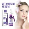 Vitamin B3 Serum Fade Dark Spot Chloasma Lighten Melanin Pigmentation Smooth Pores Rejuvenation Brightening Moisturizing Essence 5
