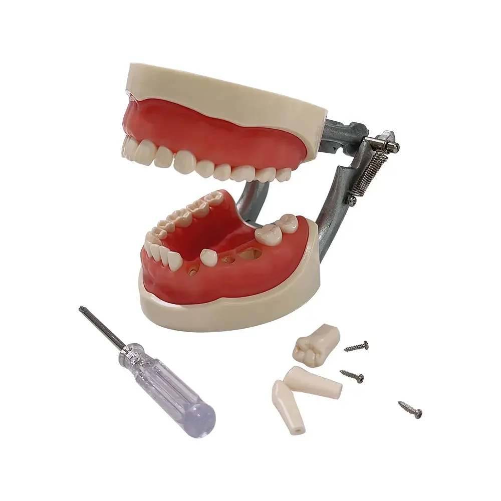 Impianto Dentale Trasparente Modello Dentale Con Denti Rimovibili Per Malattie Dentali Studio