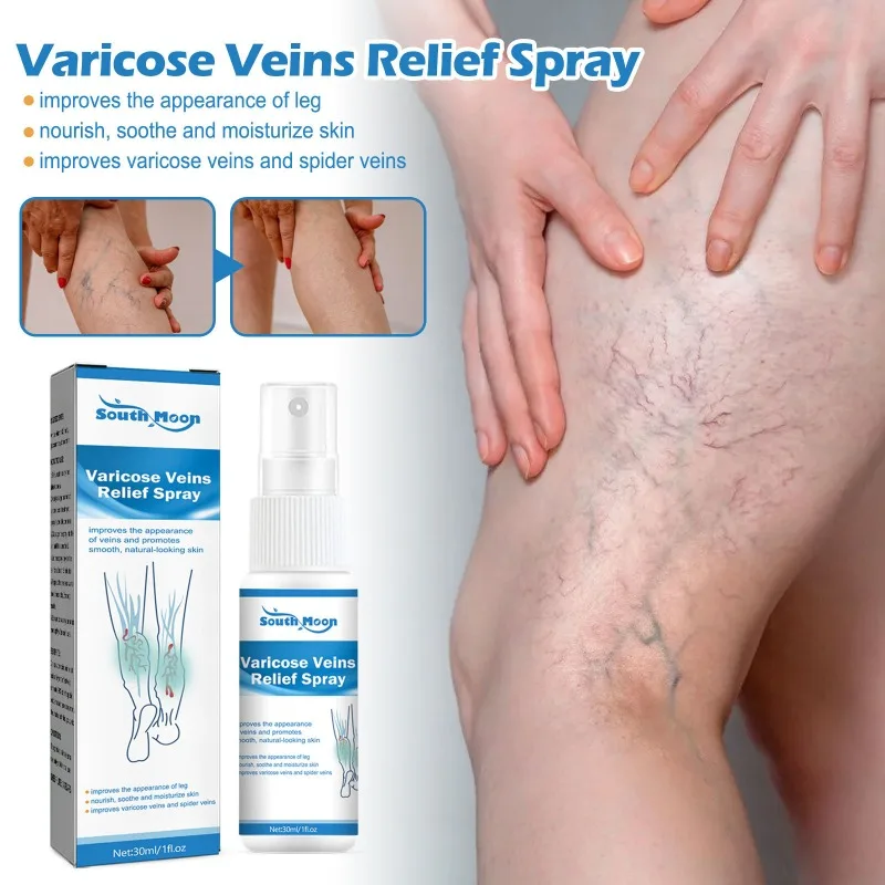Spray for Varicose Veins Effective Varicose Vein Relief Cream Relieve Leg Vasculitis Phlebitis Spider Pain Swelling Treatment